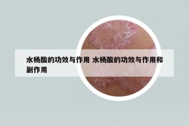 水楊酸的功效與作用 水楊酸的功效與作用和副作用