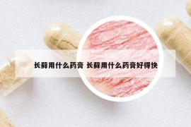 長(zhǎng)蘚用什么藥膏 長(zhǎng)蘚用什么藥膏好得快