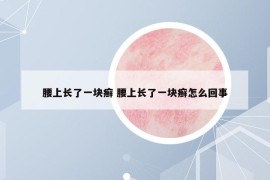 腰上長了一塊癬 腰上長了一塊癬怎么回事