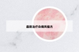 最新治療白癜風(fēng)偏方