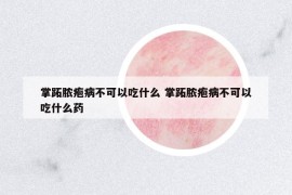 掌跖膿皰病不可以吃什么 掌跖膿皰病不可以吃什么藥