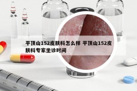 平頂山152皮膚科怎么樣 平頂山152皮膚科專家坐診時間