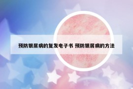 預(yù)防銀屑病的復(fù)發(fā)電子書 預(yù)防銀屑病的方法