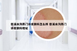 慈溪水溝弄門診皮膚科怎么樣 慈溪水溝弄門診皮膚科地址