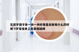 五周歲孩子身一塊一塊好像是皮鮮用什么藥好用 5歲寶寶身上皮膚粗糙癢