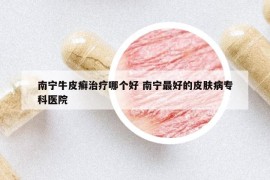 南寧牛皮癬治療哪個(gè)好 南寧最好的皮膚病?？漆t(yī)院
