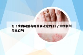 打了生物制劑有哪些要注意的 打了生物制劑后忌口嗎