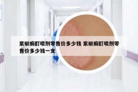 紫椒癬酊噴劑零售價多少錢 紫椒癬酊噴劑零售價多少錢一支