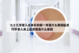 七十幾歲老人全身長的癬一樣是什么原因起皮 70歲老人身上起疙瘩是什么原因