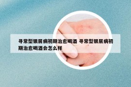 尋常型銀屑病初期治愈喝酒 尋常型銀屑病初期治愈喝酒會(huì)怎么樣