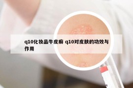 q10化妝品牛皮癬 q10對皮膚的功效與作用