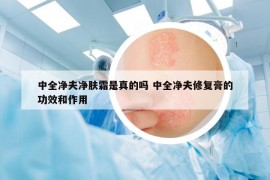 中全凈夫凈膚霜是真的嗎 中全凈夫修復膏的功效和作用