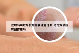 注射烏司奴單抗后需要注意什么 烏司奴單抗有副作用嗎