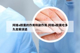 阿維a膠囊的作用和副作用 阿維a膠囊吃多久皮癬消退