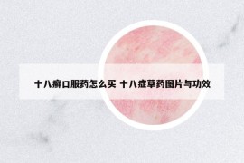 十八癬口服藥怎么買 十八癥草藥圖片與功效