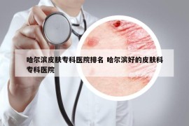 哈爾濱皮膚?？漆t(yī)院排名 哈爾濱好的皮膚科?？漆t(yī)院