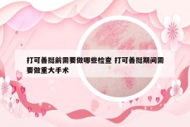 打可善挺前需要做哪些檢查 打可善挺期間需要做重大手術(shù)