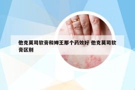 他克莫司軟膏和嬋王那個藥效好 他克莫司軟膏區(qū)別