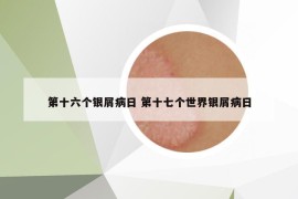第十六個(gè)銀屑病日 第十七個(gè)世界銀屑病日