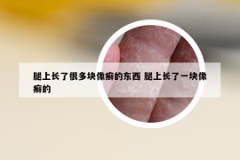 腿上長了很多塊像癬的東西 腿上長了一塊像癬的