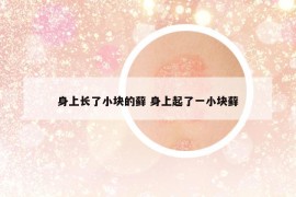 身上長了小塊的蘚 身上起了一小塊蘚