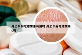 身上長癬吃維生素有用嗎 身上長蘚吃維生素c嗎