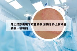 身上局部出現(xiàn)了紅色的癬也似的 身上有紅色的癬一塊塊的