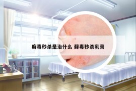 癬毒秒殺是治什么 蘚毒秒殺乳膏