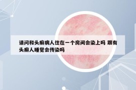 請問和頭癬病人住在一個(gè)房間會染上嗎 跟有頭癬人睡覺會傳染嗎