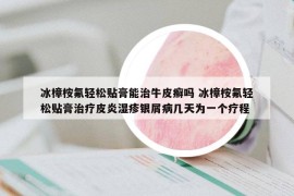 冰樟桉氟輕松貼膏能治牛皮癬嗎 冰樟桉氟輕松貼膏治療皮炎濕疹銀屑病幾天為一個(gè)療程