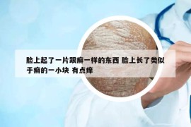 臉上起了一片跟癬一樣的東西 臉上長(zhǎng)了類似于癬的一小塊 有點(diǎn)癢