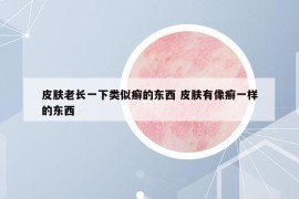 皮膚老長一下類似癬的東西 皮膚有像癬一樣的東西