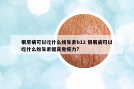 銀屑病可以吃什么維生素b12 銀屑病可以吃什么維生素提高免疫力?
