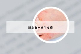 臉上有一點牛皮癬