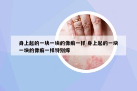 身上起的一塊一塊的像癬一樣 身上起的一塊一塊的像癬一樣特別癢