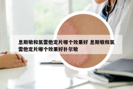 息斯敏和氯雷他定片哪個(gè)效果好 息斯敏和氯雷他定片哪個(gè)效果好撲爾敏