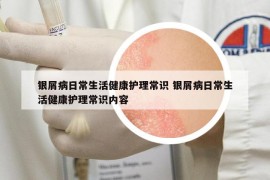 銀屑病日常生活健康護(hù)理常識(shí) 銀屑病日常生活健康護(hù)理常識(shí)內(nèi)容