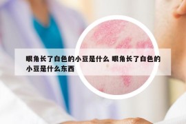 眼角長(zhǎng)了白色的小豆是什么 眼角長(zhǎng)了白色的小豆是什么東西