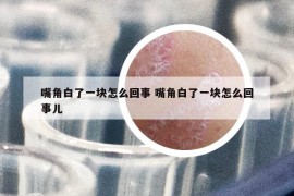 嘴角白了一塊怎么回事 嘴角白了一塊怎么回事兒