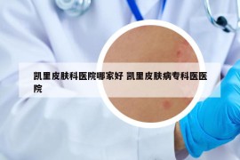 凱里皮膚科醫(yī)院哪家好 凱里皮膚病?？漆t(yī)醫(yī)院