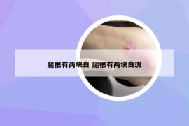 腿根有兩塊白 腿根有兩塊白斑