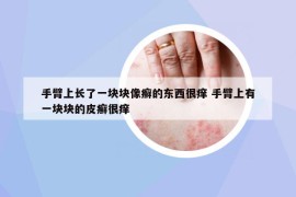 手臂上長了一塊塊像癬的東西很癢 手臂上有一塊塊的皮癬很癢