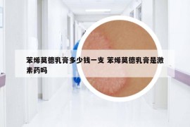 苯烯莫德乳膏多少錢一支 苯烯莫德乳膏是激素藥嗎