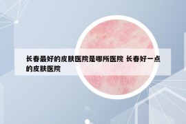 長春最好的皮膚醫(yī)院是哪所醫(yī)院 長春好一點的皮膚醫(yī)院