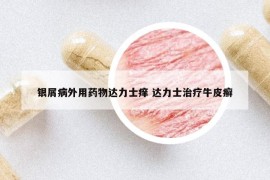 銀屑病外用藥物達(dá)力士癢 達(dá)力士治療牛皮癬
