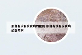 邢臺有沒有皮膚病的醫(yī)院 邢臺有沒有皮膚病的醫(yī)院啊