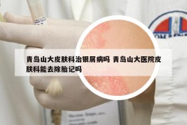 青島山大皮膚科治銀屑病嗎 青島山大醫(yī)院皮膚科能去除胎記嗎