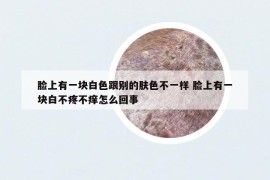臉上有一塊白色跟別的膚色不一樣 臉上有一塊白不疼不癢怎么回事