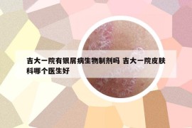 吉大一院有銀屑病生物制劑嗎 吉大一院皮膚科哪個(gè)醫(yī)生好