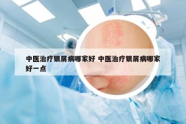 中醫(yī)治療銀屑病哪家好 中醫(yī)治療銀屑病哪家好一點
